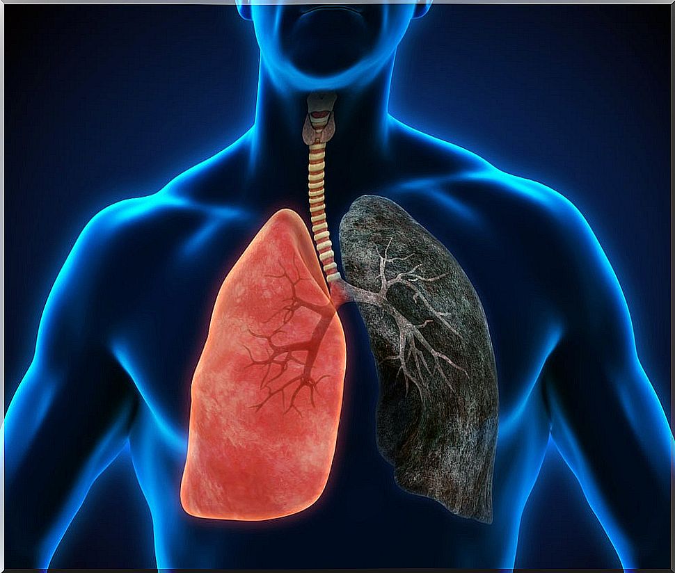 Bad habits that deteriorate your lung health