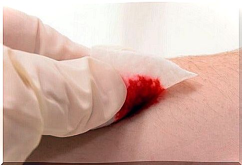 A gel that stops bleeding in just 10 seconds