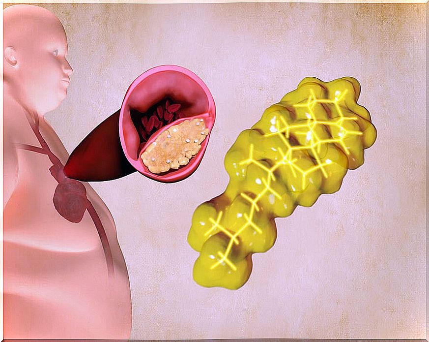 What are triglycerides?