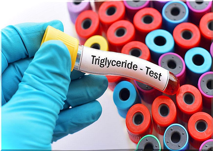 Triglyceride test