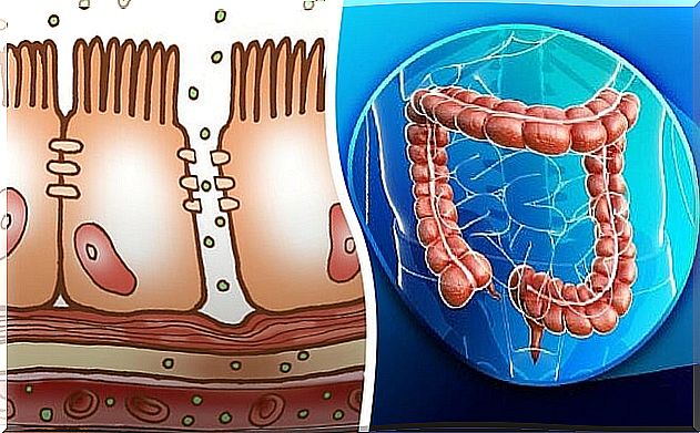 What is a leaky gut and how it can affect your health