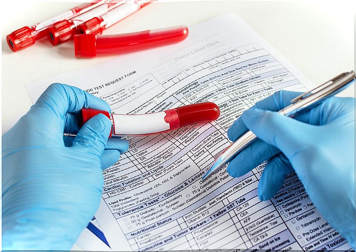 Values ​​that indicate low neutrophils in the blood