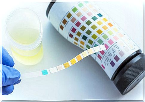 What does a urinalysis detect?