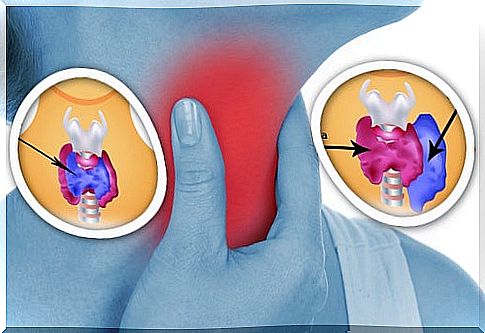 thyroid abnormality